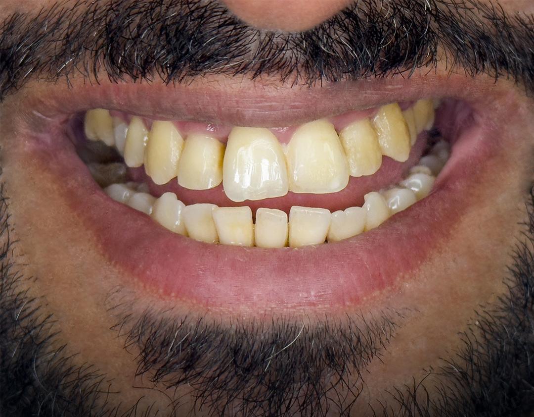 Before image