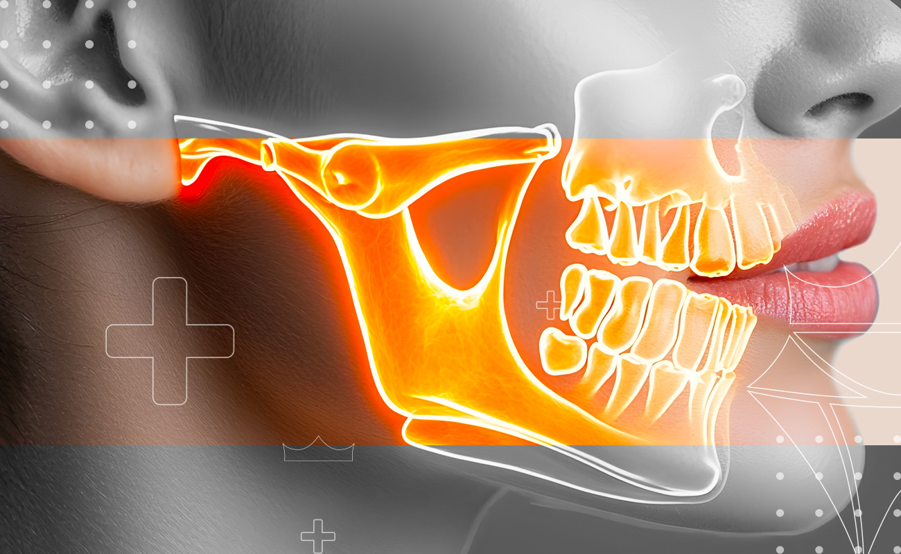 SaphireDent-Bone-Grafting-02