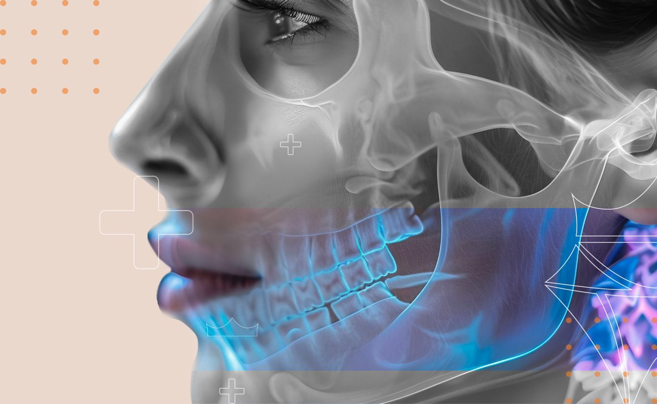 SaphireDent-Zygomatic01