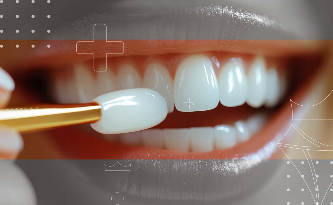 SaphireDent-HollywoodSmile-01