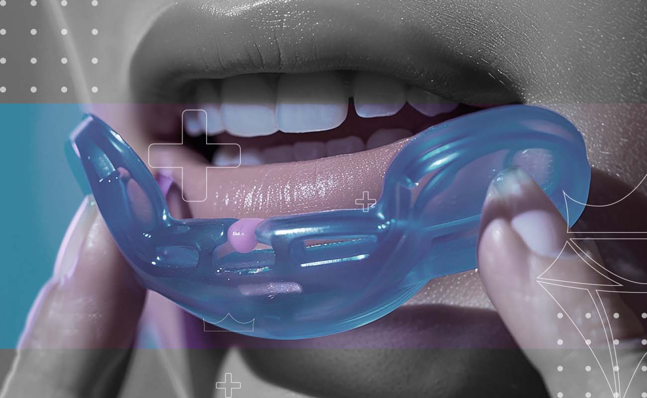 saphiredent-mouthguards-2