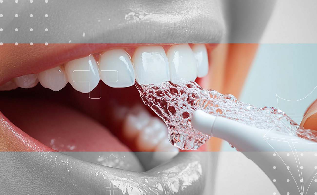 SaphireDent-Professional-Teeth-Cleaning-02