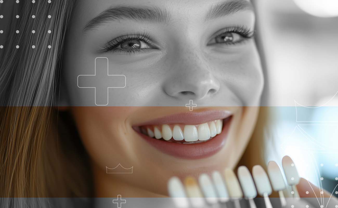 SaphireDent-Tooth-Colored-Fillings-02