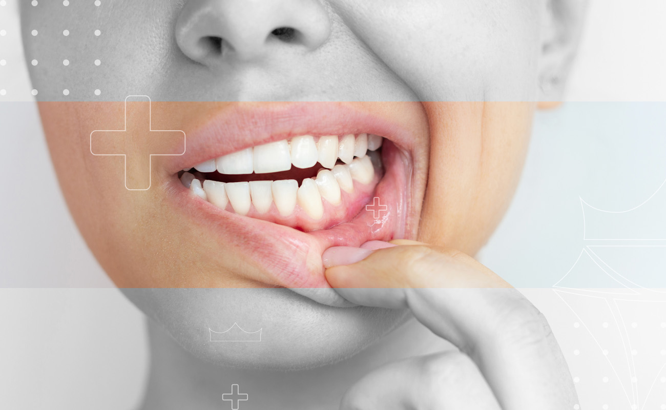 SaphireDent-Bone-Regeneration