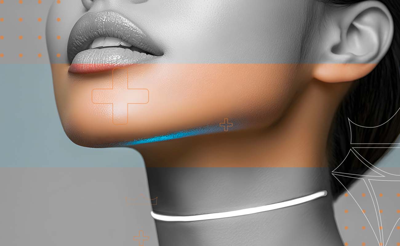 SaphireDent-Jaw-Alignment-Surgery-02