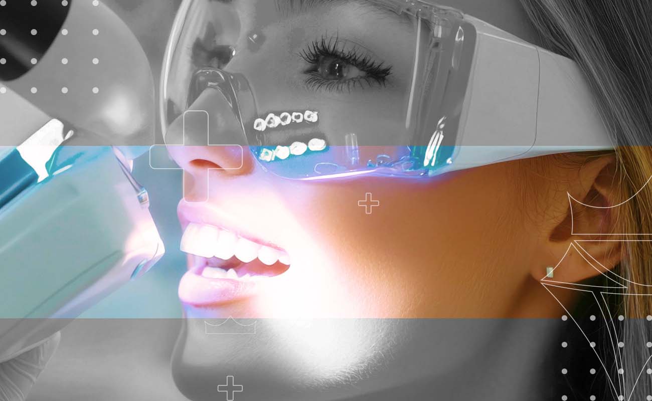 SaphireDent-Laser-Teeth-Whitening-02